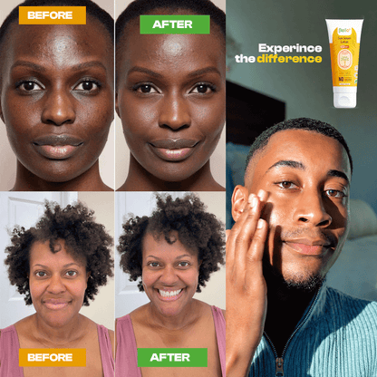 Sun-screen Lotion